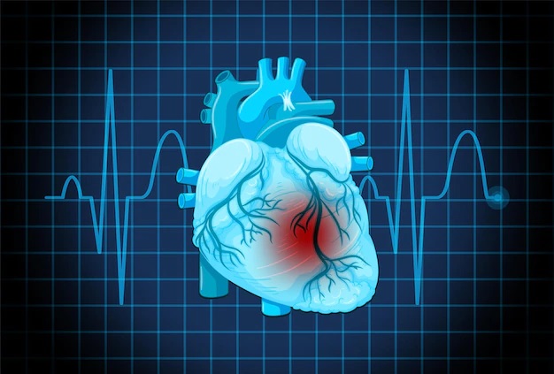 Holiday Heart Syndrome: What is it? which are crucial indicators.